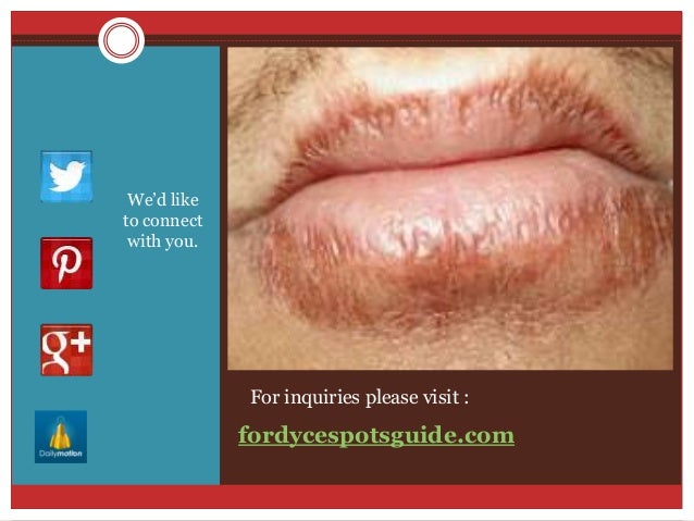 Papules On How Of Get To Penile Shaft Rid Papules On How Of Get To Penile Shaft Rid